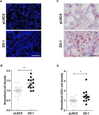 ZO-1 Intracellular Localization Organizes Immune Response in Non-Small Cell Lung Cancer